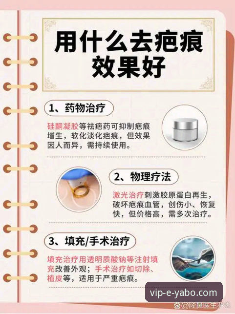 如何在亚博888VIP平台深度解读莱切后防危机？